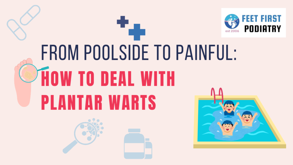 From Poolside to Painful: How to Deal with Plantar Warts Feet_First_Podiatry_Plantar_Warts