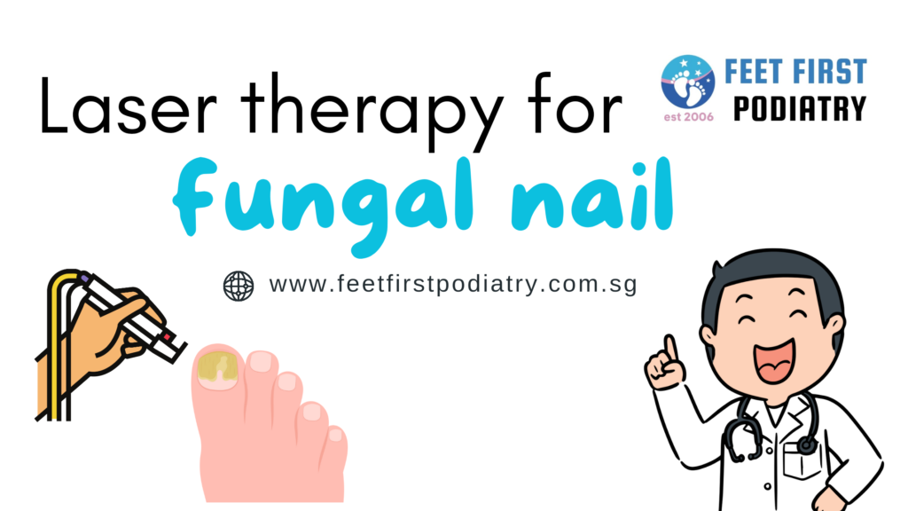 Understanding Nail Fungus and Exploring Treatment Options Laser Treatment For Fungal Toenail