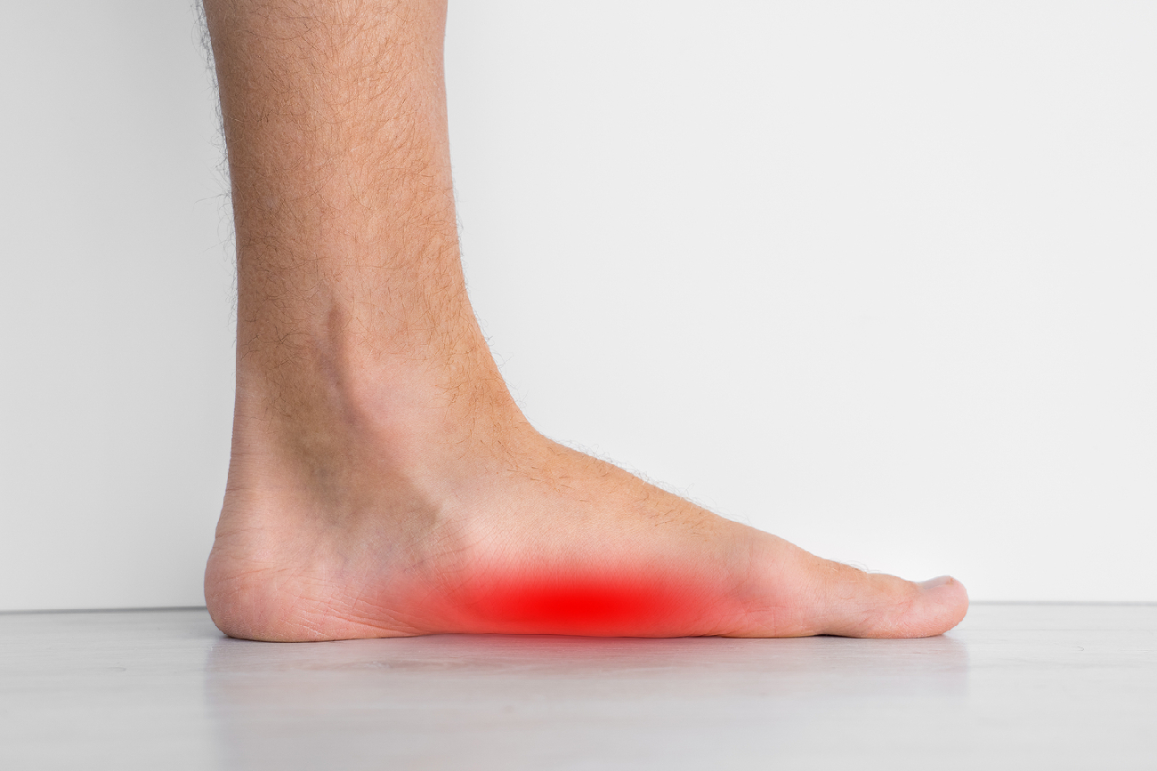 Can You Develop Flat Feet Later in Life? Causes to Know