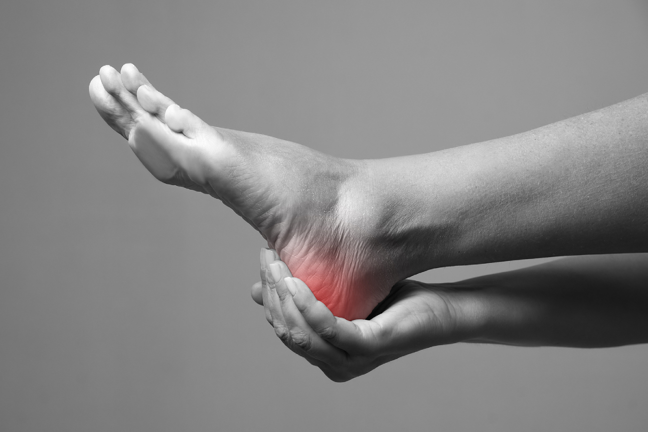 Is Your Heel Pain Plantar Fasciitis? Here's How to Tell