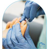 Ingrown Toenail Feet First Podiatry