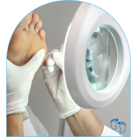 foot wart podiatry treatment