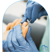 Podiatry Clinic Singapore – Ingrown Toenail Podiatry Clinic Singapore - Ingrown Toenail